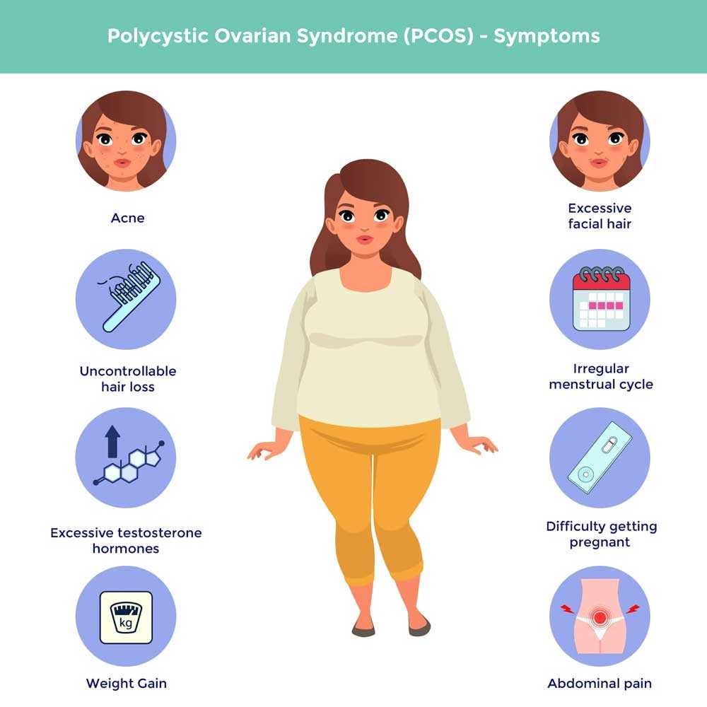 Symptoms of polycystic ovarian syndrome